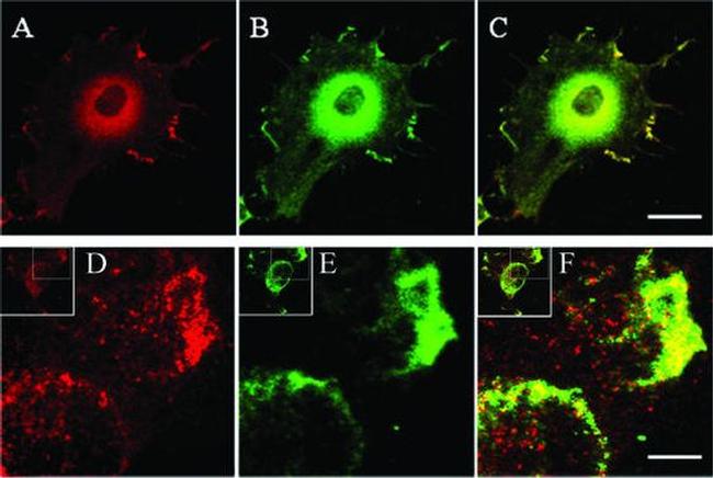 Acetylcholinesterase Antibody in Immunocytochemistry (ICC/IF)