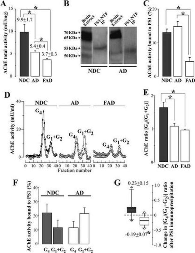 Acetylcholinesterase Antibody in Western Blot (WB)