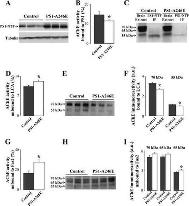 Acetylcholinesterase Antibody in Western Blot (WB)