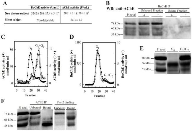 Acetylcholinesterase Antibody in Western Blot, Immunoprecipitation (WB, IP)