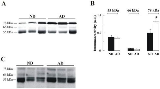 Acetylcholinesterase Antibody in Western Blot (WB)