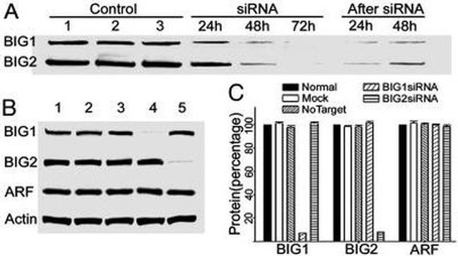 ARF1/ARF3/ARF5/ARF6 Antibody in Western Blot (WB)