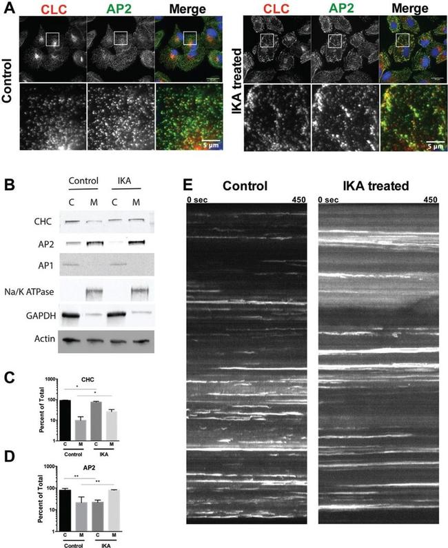 alpha Adaptin Antibody in Western Blot (WB)