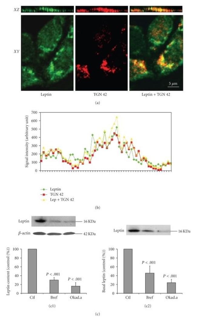 TGN46 Antibody in Immunocytochemistry (ICC/IF)