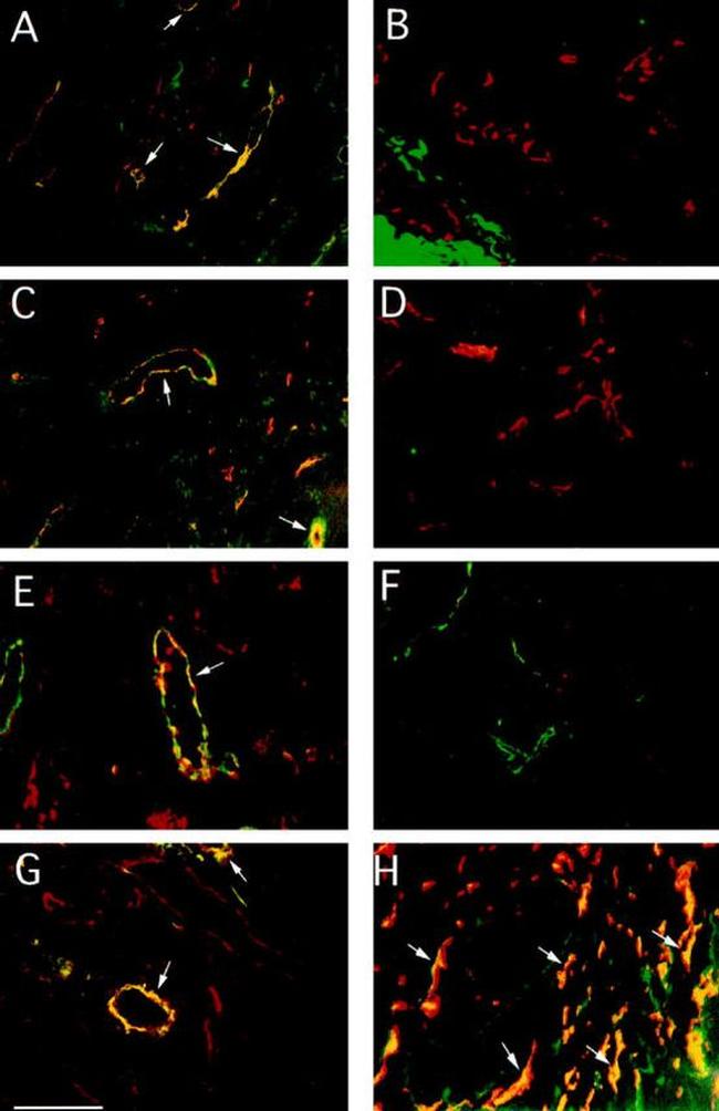 CD31 Antibody in Immunohistochemistry (IHC)