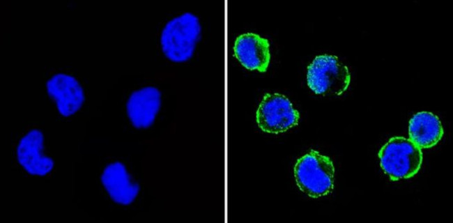 CD31 Antibody in Immunocytochemistry (ICC/IF)