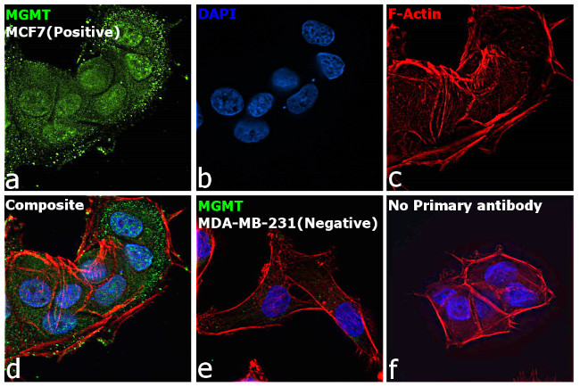 MGMT Antibody in Immunocytochemistry (ICC/IF)