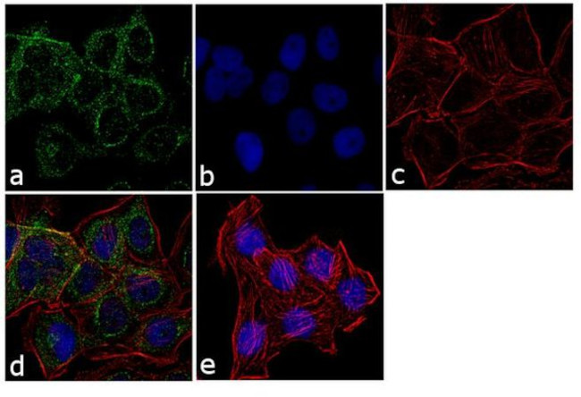 TSH Receptor Antibody in Immunocytochemistry (ICC/IF)