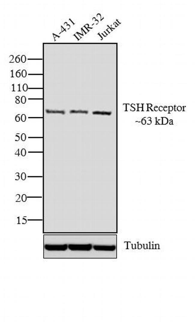 TSH Receptor Antibody in Western Blot (WB)