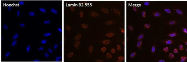 Lamin B2 Antibody in Immunocytochemistry (ICC/IF)