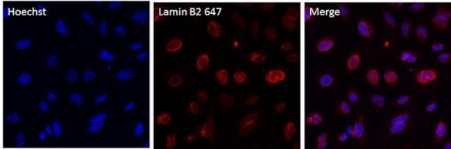 Lamin B2 Antibody in Immunocytochemistry (ICC/IF)