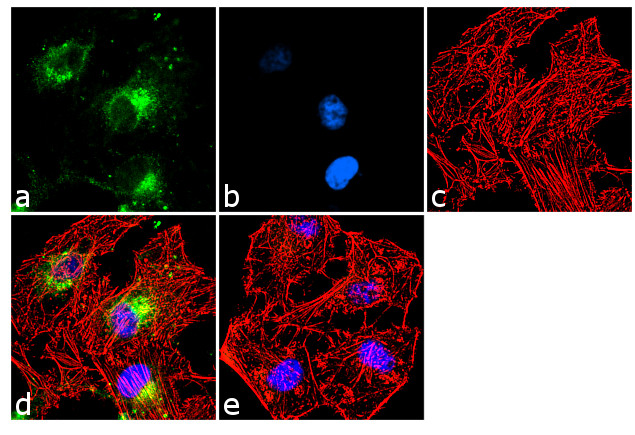 HIP Antibody in Immunocytochemistry (ICC/IF)