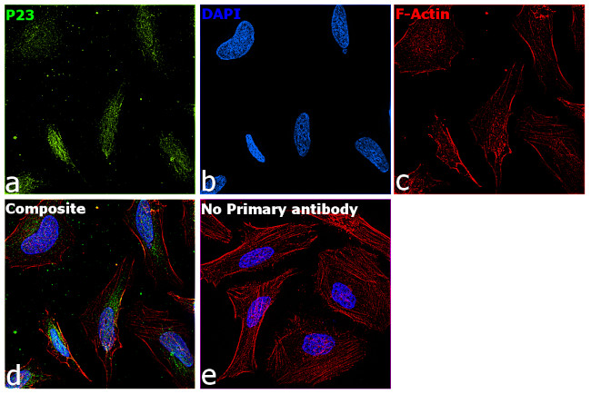 p23 Antibody in Immunocytochemistry (ICC/IF)