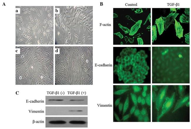 Vimentin Antibody in Western Blot, Immunocytochemistry (WB, ICC/IF)