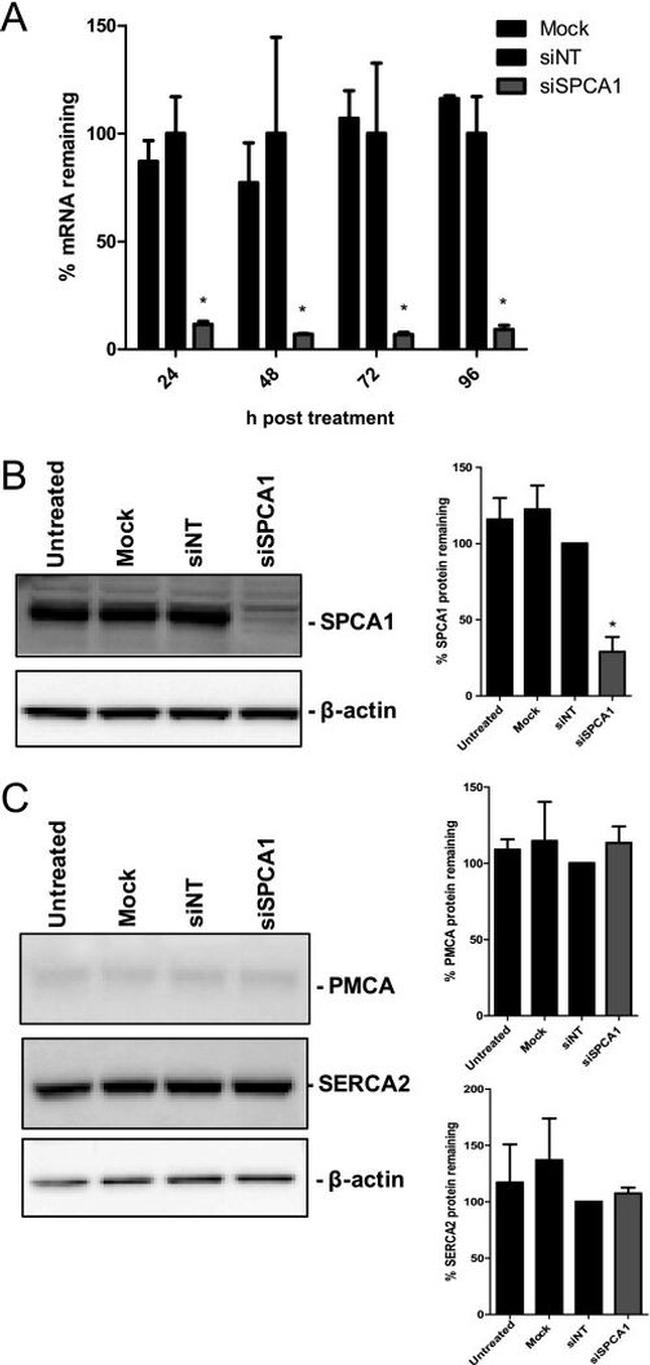 SERCA2 ATPase Antibody in Western Blot (WB)