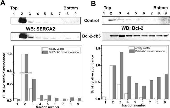 SERCA2 ATPase Antibody in Western Blot (WB)