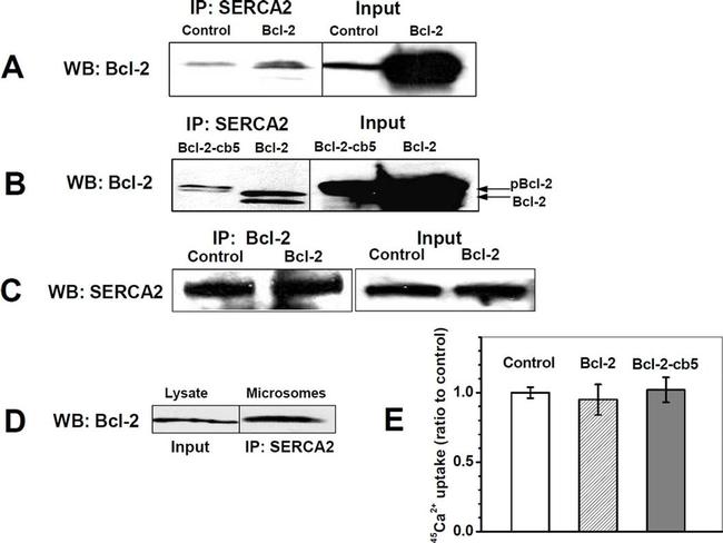 SERCA2 ATPase Antibody in Western Blot, Immunoprecipitation (WB, IP)