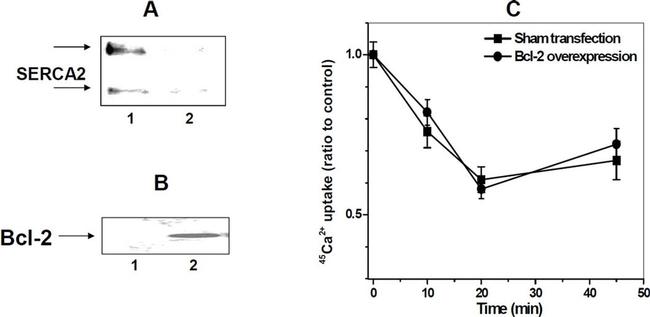 SERCA2 ATPase Antibody in Western Blot (WB)