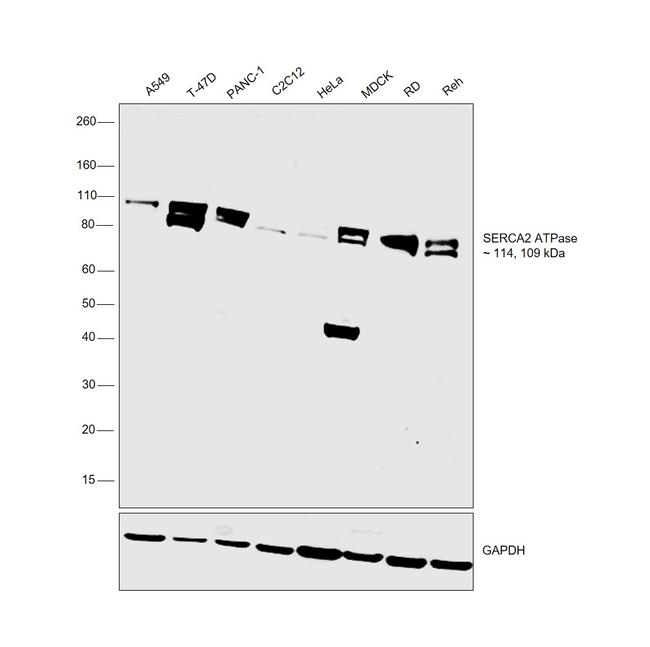 SERCA2 ATPase Antibody in Western Blot (WB)