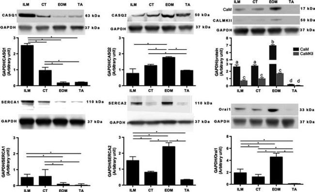 Calsequestrin Antibody in Western Blot (WB)