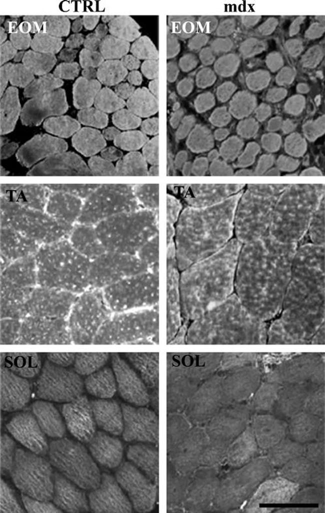 Calsequestrin Antibody in Immunohistochemistry (IHC)