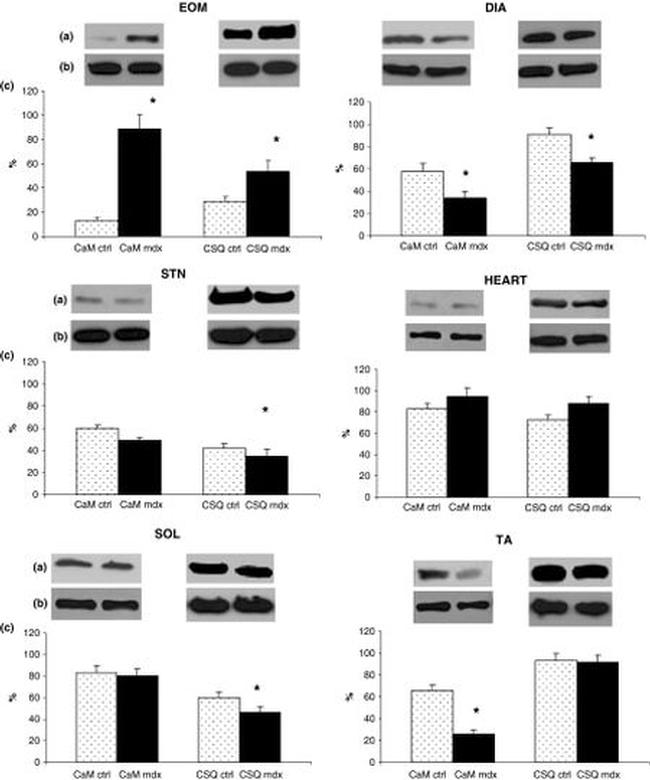 Calsequestrin Antibody in Western Blot (WB)