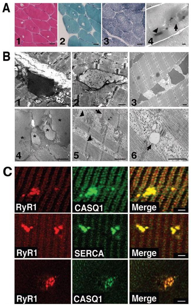 Calsequestrin Antibody in Immunohistochemistry (IHC)