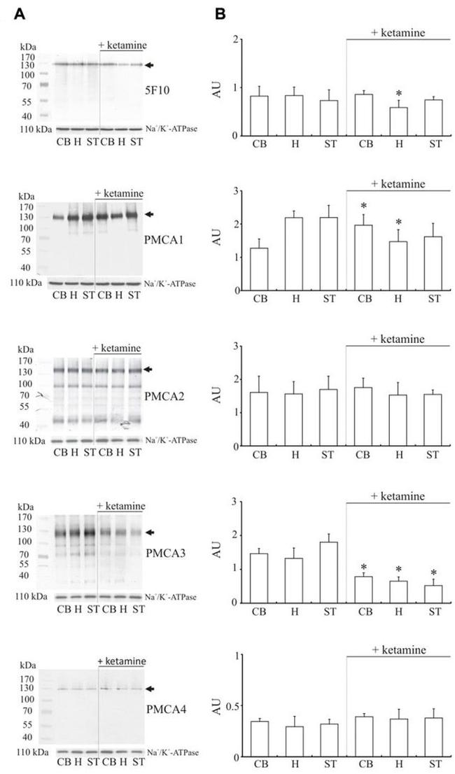 PMCA ATPase Antibody in Western Blot (WB)