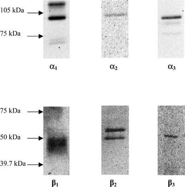 ATP1A3 Antibody in Western Blot (WB)