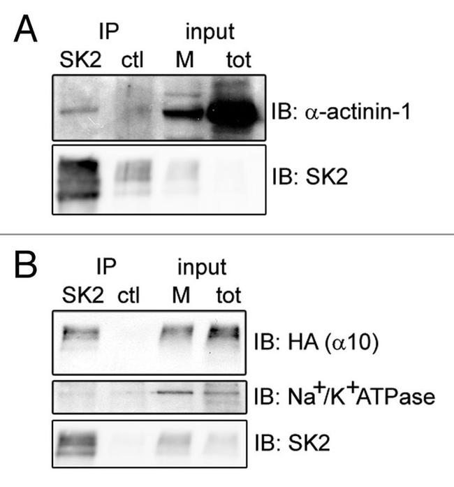 ATP1A3 Antibody in Western Blot (WB)