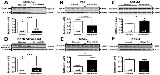 ATP1A3 Antibody in Western Blot (WB)