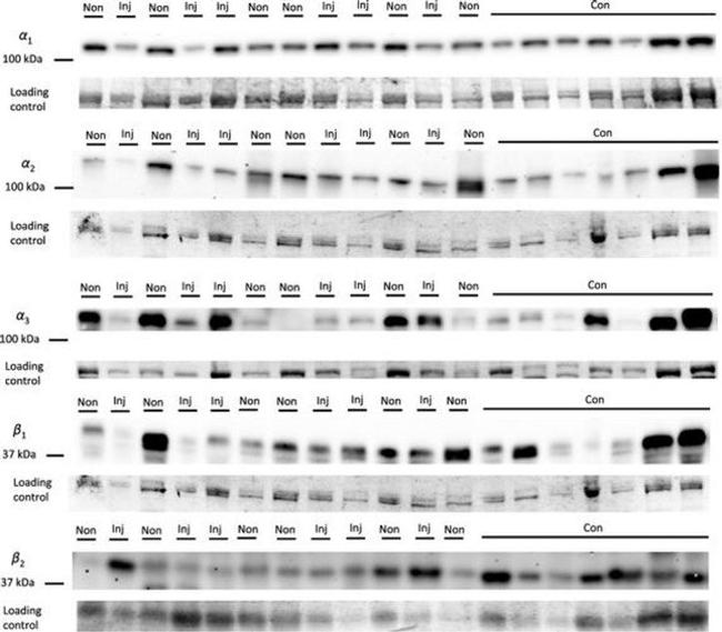 ATP1A3 Antibody in Western Blot (WB)