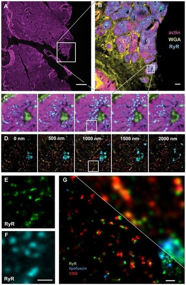 Calsequestrin Antibody in Immunohistochemistry (IHC)