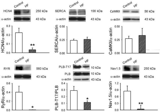 Phospholamban Antibody in Western Blot (WB)