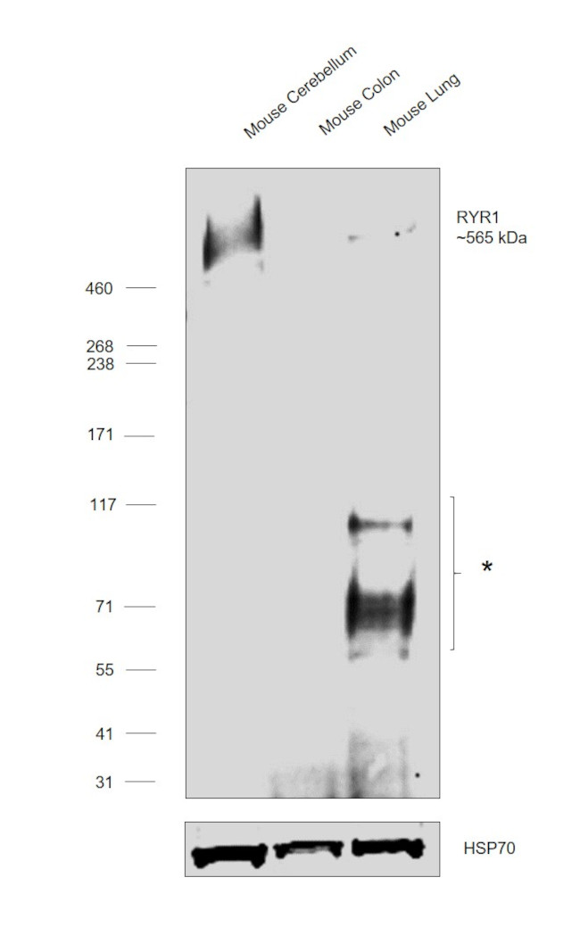 Ryanodine Receptor Antibody