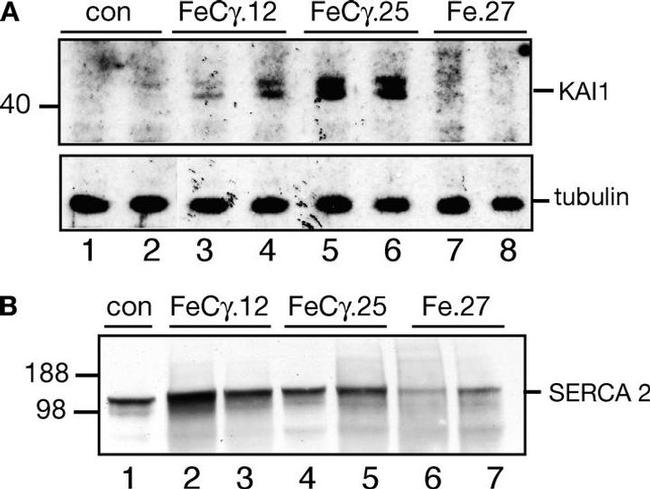 SERCA2 ATPase Antibody in Western Blot (WB)