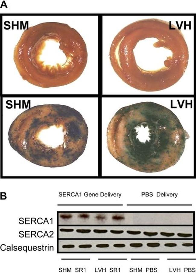 SERCA2 ATPase Antibody in Western Blot (WB)