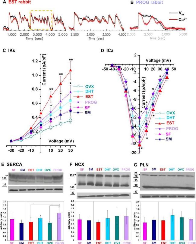 Phospholamban Antibody in Western Blot (WB)