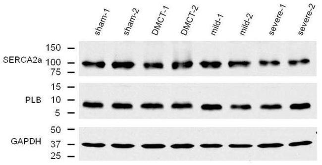 SERCA2 ATPase Antibody in Western Blot (WB)