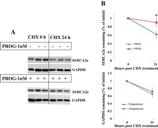 SERCA2 ATPase Antibody in Western Blot (WB)