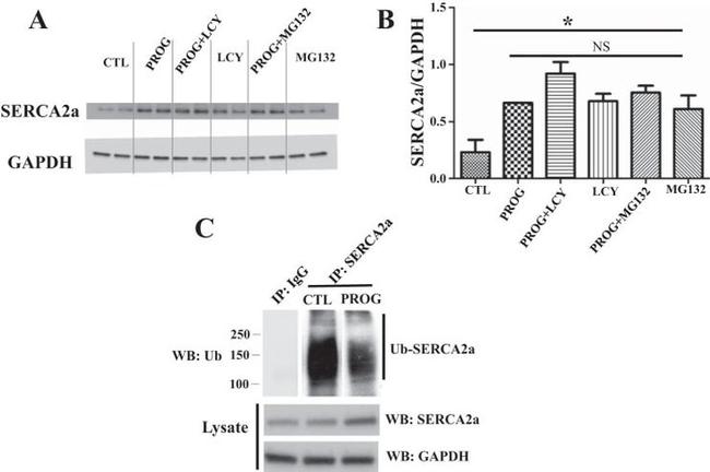 SERCA2 ATPase Antibody in Western Blot, Immunoprecipitation (WB, IP)