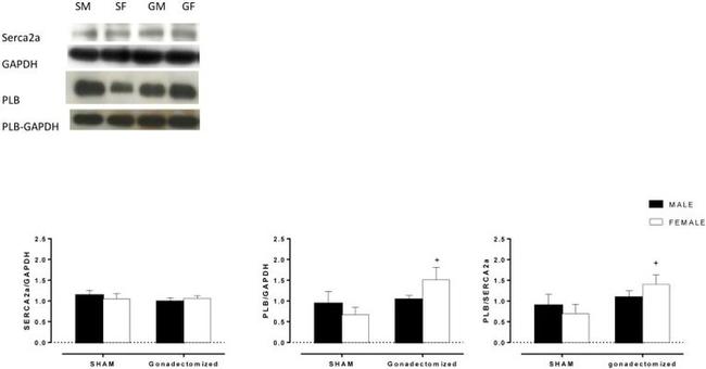 Phospholamban Antibody in Western Blot (WB)