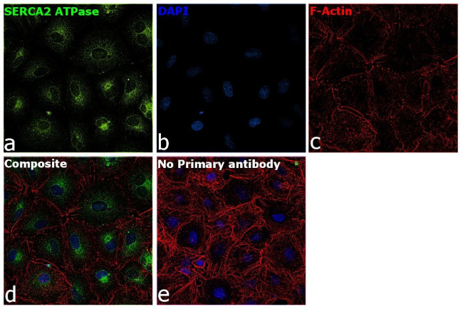 SERCA2 ATPase Antibody in Immunocytochemistry (ICC/IF)