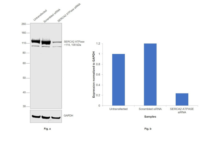 SERCA2 ATPase Antibody