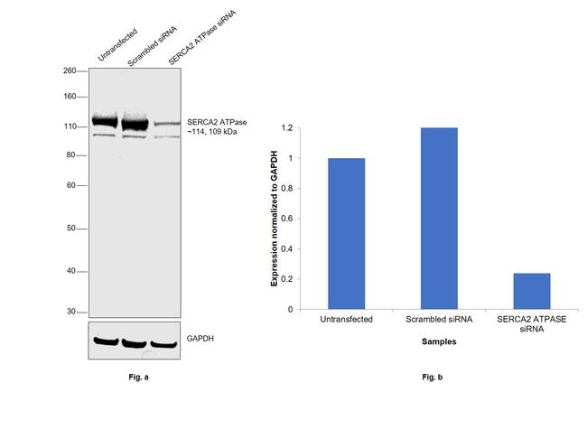 SERCA2 ATPase Antibody in Western Blot (WB)