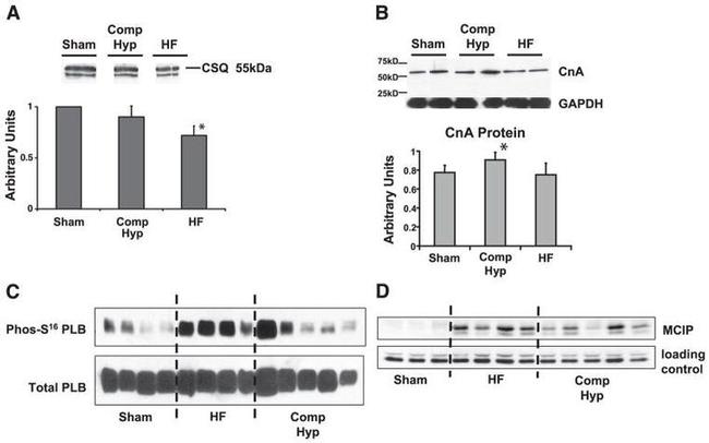 Calsequestrin Antibody in Western Blot (WB)