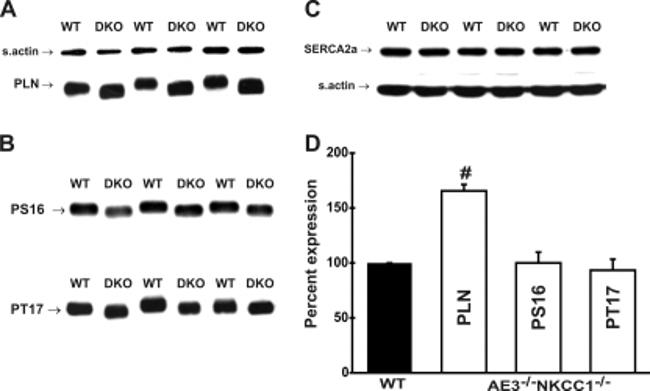 Phospholamban Antibody in Western Blot (WB)