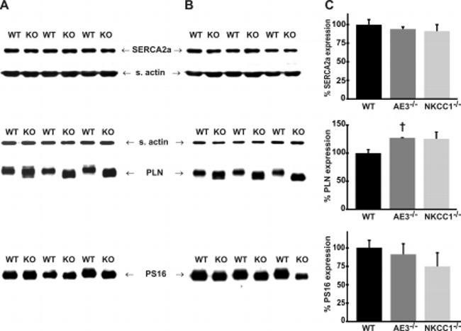 Phospholamban Antibody in Western Blot (WB)