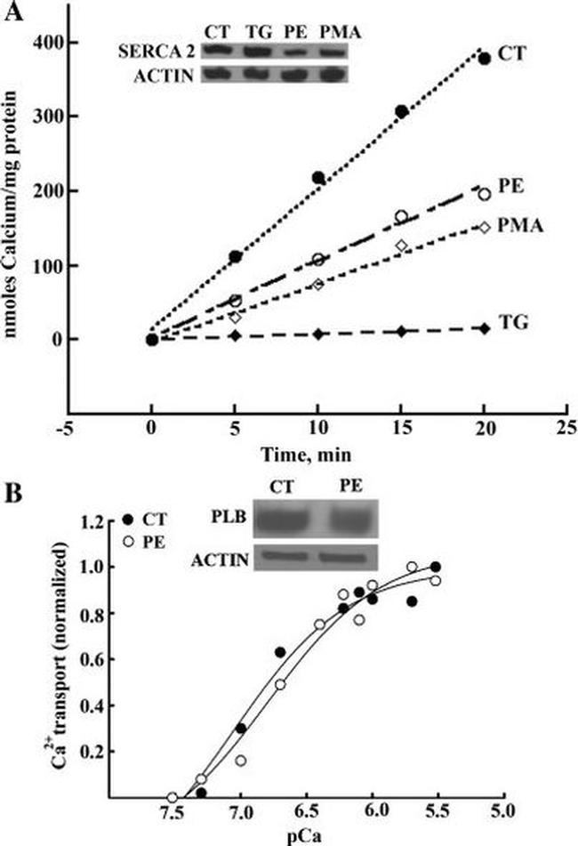 Phospholamban Antibody in Western Blot (WB)