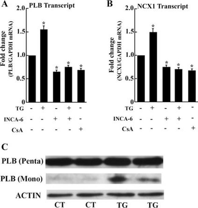 Phospholamban Antibody in Western Blot (WB)